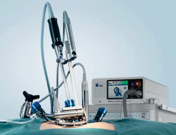 Image: The active surgical assistance system ViKY (Photo courtesy of TRUMPF Medical Systems). Image: The active surgical assistance system ViKY (Photo courtesy of TRUMPF Medical Systems).